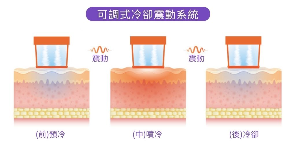 客製化冷噴劑量