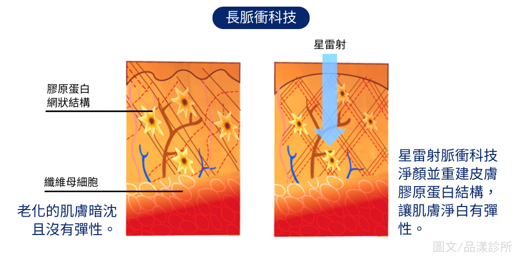 長脈衝科技