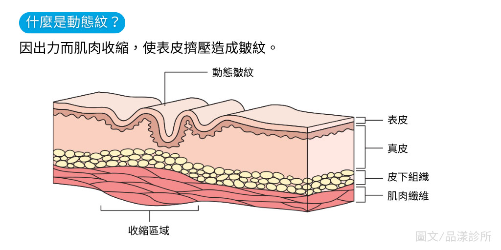 什麼是動態紋表情紋