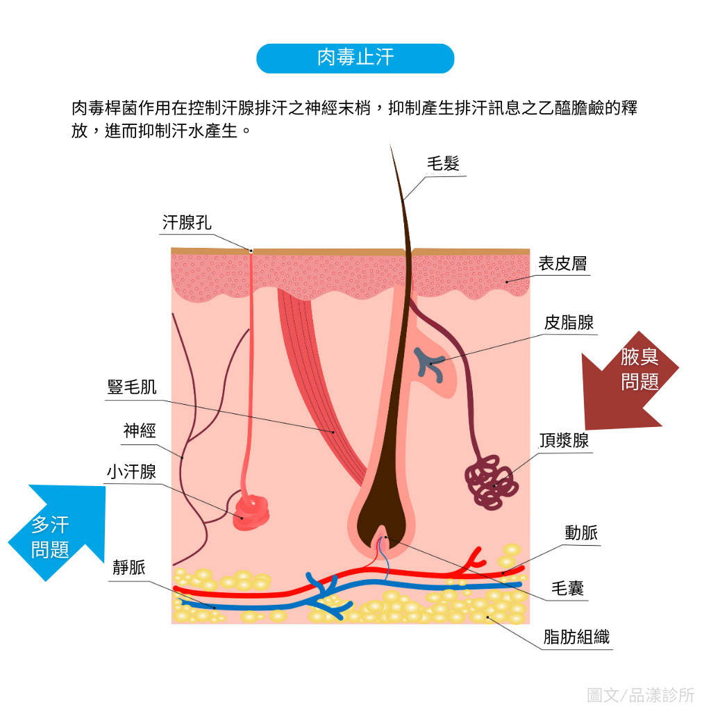 肉毒桿菌作用原理