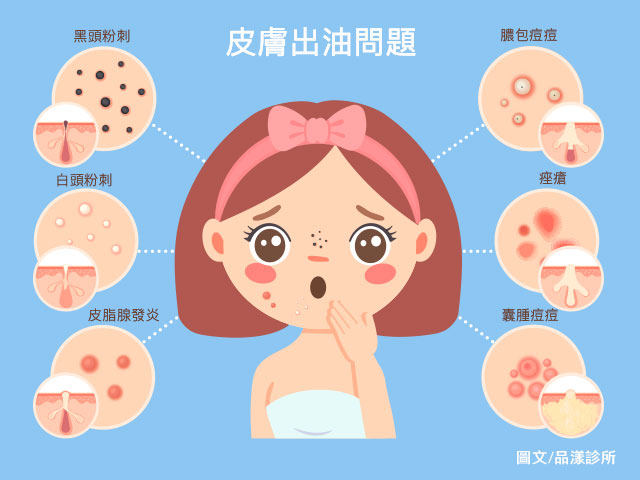粉刺痘痘問題 640x480